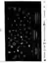 Fig. 28 - Extracellular novel RAGE binding protein ( EN-RAGE) and uses thereof