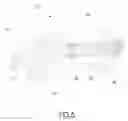 Fig. 05 - Moon clip server