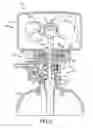 Fig. 06 - Pivotable control valve assembly for water treatment device