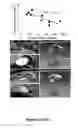 Fig. 19 - Methods and compositions for treating inflammatory conditions