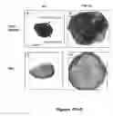 Fig. 22 - Methods and compositions for treating inflammatory conditions