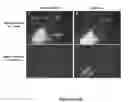 Fig. 38 - Methods and compositions for treating inflammatory conditions