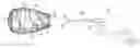 Fig. 01 - Methods for removing concrete accretions from mixing drum