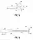 Fig. 05 - Methods for removing concrete accretions from mixing drum