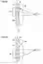 Fig. 03 - IMAGING SUPPORT DEVICE FOR RADIOGRAPHIC LONG LENGTH IMAGING