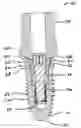 Fig. 01 - Dental implant system