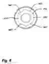 Fig. 07 - Dental implant system