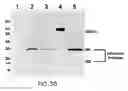 Fig. 05 - Assembly of wild-type and chimeric influenza virus-like particles (VLPs)