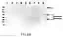 Fig. 15 - Assembly of wild-type and chimeric influenza virus-like particles (VLPs)