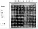 Fig. 01 - Affinity Polypeptide for Purification of Recombinant Proteins