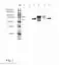 Fig. 08 - Immunization with bacterial ghost-based vaccines