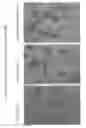Fig. 02 - Dedifferentiated, Programmable Stem Cells of Monocytic Origin, and Their Production and Use