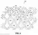 Fig. 03 - System and method for providing a lacrosse stick mesh
