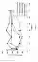 Fig. 03 - Fusion protein of exendin-4 to a transferrin (Tf) polypeptide