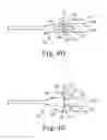 Fig. 06 - Surgical articles and methods for treating pelvic conditions