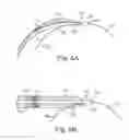 Fig. 07 - Surgical articles and methods for treating pelvic conditions