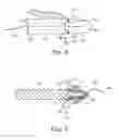 Fig. 08 - Surgical articles and methods for treating pelvic conditions