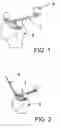 Fig. 02 - System for navigation-assisted shoulder operations and navigation method for positioning navigated treatment apparatuses with respect to a bone