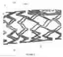Fig. 09 - STENT EXPANSION COLUMN, STRUT AND CONNECTOR SLIT DESIGN