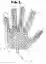 Fig. 02 - Med ready gloves