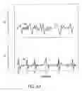 Fig. 10 - Vibroacoustic Bathing Systtem