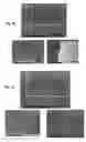 Fig. 09 - DEEP REACTIVE ION ETCHING