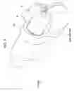 Fig. 08 - Wire feeding unit