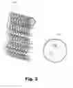 Fig. 04 - Explosion resistant gas tank design