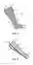 Fig. 04 - Aid for Pulling Off Elastic Stockings