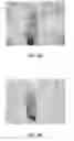 Fig. 09 - Method for thermal crosslinking of previously irradiated polymeric material and medical implant