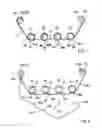 Fig. 06 - Power tool carriers