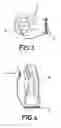 Fig. 03 - System for Releasing Binding Elements for Ski or Snowboard Boots and Similar