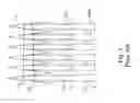 Fig. 06 - Reduction of power consumption and EMI of a switching amplifier