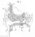 Fig. 02 - Alternative mass arrangements for bone conduction devices
