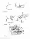 Fig. 02 - METHOD AND KIT INCLUDING STOP ELEMENTS FOR CORRECTING DENTAL MALOCCLUSIONS WITH PRE-FORMED NITINOL ARCHES