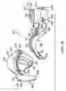 Fig. 03 - Intraoral device