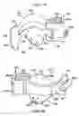 Fig. 04 - Intraoral device