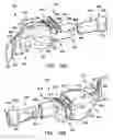 Fig. 10 - Intraoral device
