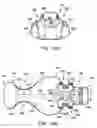 Fig. 12 - Intraoral device