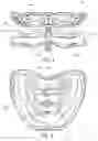 Fig. 04 - Integrated modular dental measuring apparatus and method for dentures