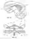 Fig. 10 - Integrated modular dental measuring apparatus and method for dentures