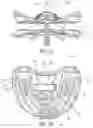 Fig. 11 - Integrated modular dental measuring apparatus and method for dentures