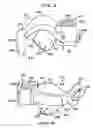 Fig. 04 - Intraoral device