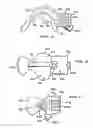 Fig. 05 - Intraoral device
