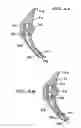 Fig. 06 - Intraoral device