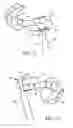 Fig. 05 - Dental tool
