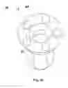 Fig. 06 - Multi-position abutment with angular ball attachment for dental implants
