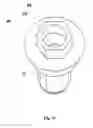 Fig. 07 - Multi-position abutment with angular ball attachment for dental implants
