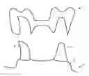 Fig. 01 - Method, computer, machine-readable medium, computer program and system, concerning the manufacture of dental prostheses