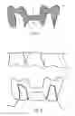Fig. 03 - Method, computer, machine-readable medium, computer program and system, concerning the manufacture of dental prostheses